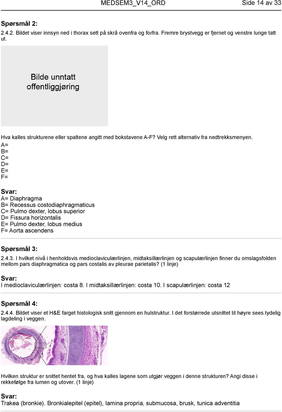 A= B= C= D= E= F= A= Diaphragma B= Recessus costodiaphragmaticus C= Pulmo dexter, lobus superior D= Fissura horizontalis E= Pulmo dexter, lobus medius F= Aorta ascendens Spørsmål 3: