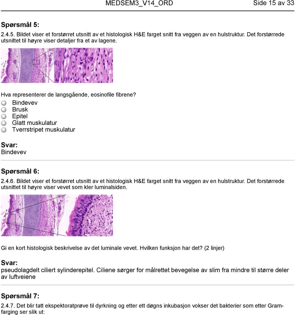 Bindevev Brusk Epitel Glatt muskulatur Tverrstripet muskulatur Bindevev Spørsmål 6: 2.4.6. Bildet viser et forstørret utsnitt av et histologisk H&E farget snitt fra veggen av en hulstruktur.