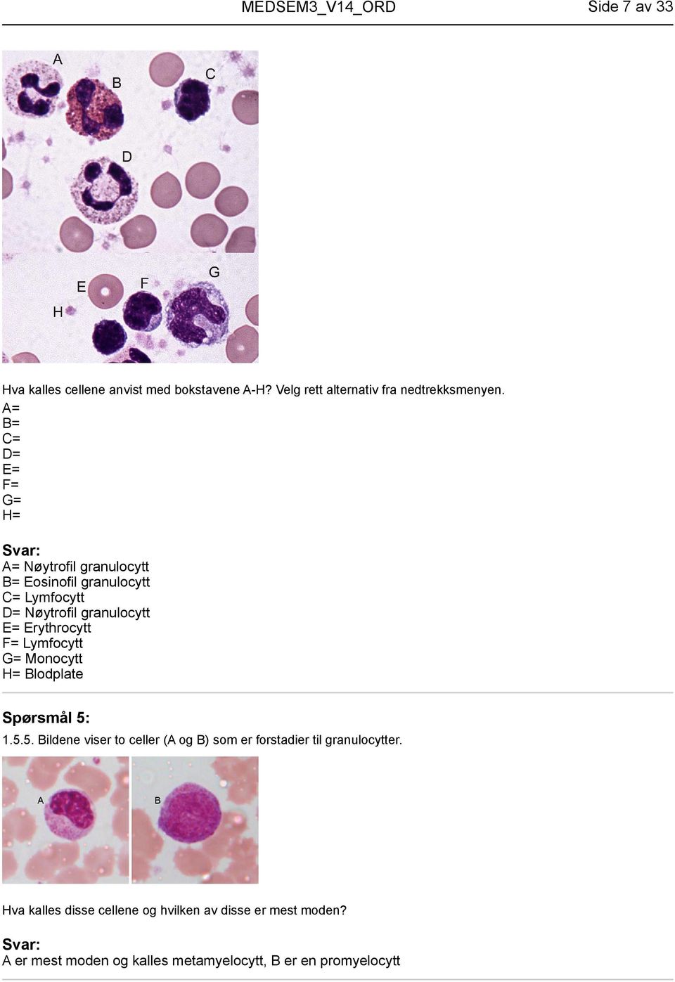 Erythrocytt F= Lymfocytt G= Monocytt H= Blodplate Spørsmål 5: