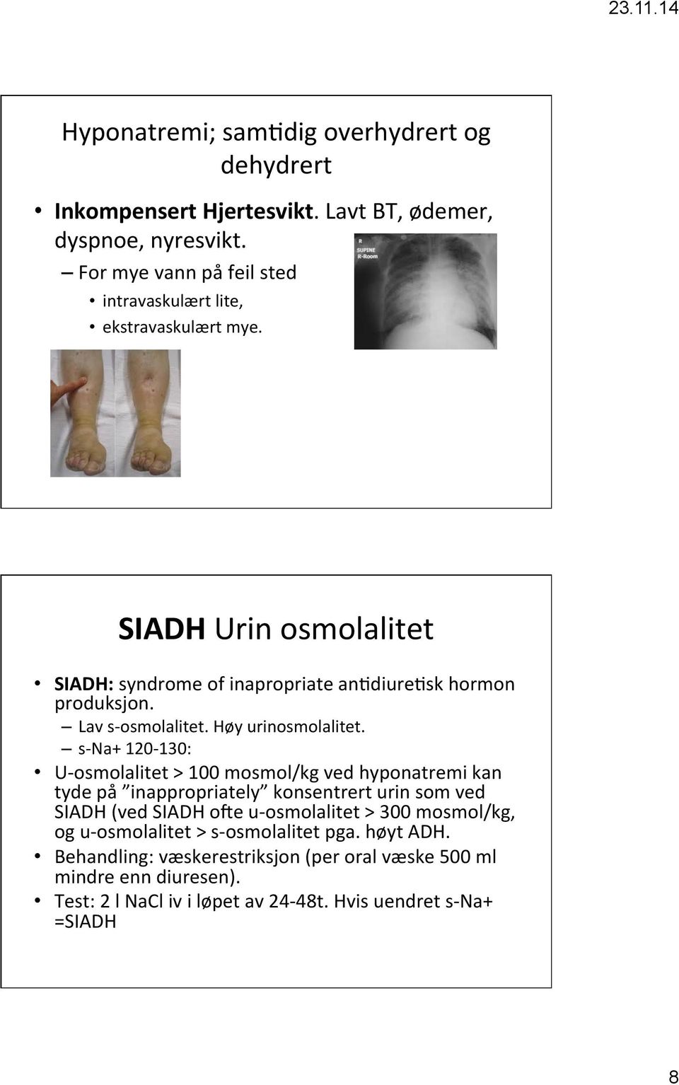 Lav s- osmolalitet. Høy urinosmolalitet.