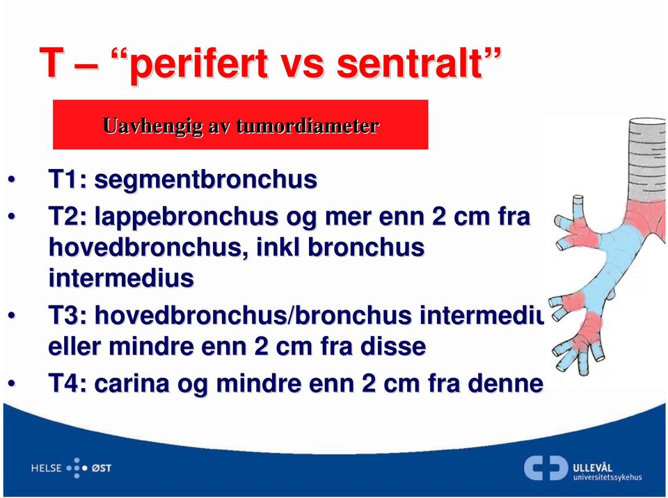 hovedbronchus, inkl bronchus intermedius T3: