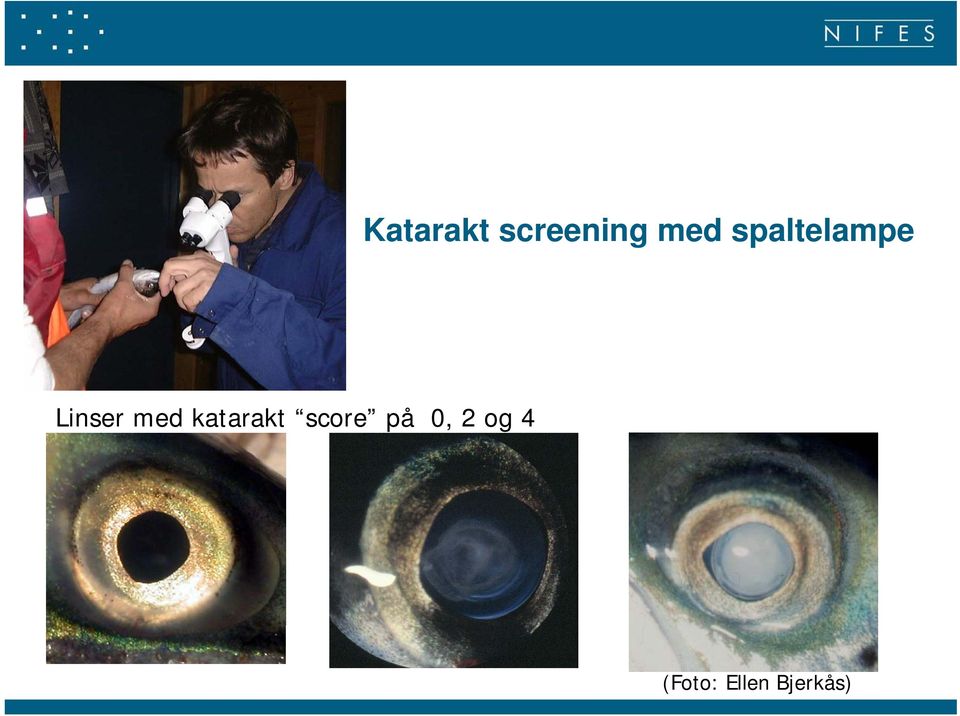 katarakt score på 0, 2