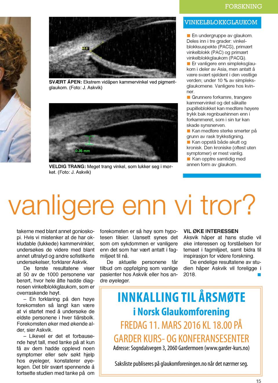 Er vanligere enn simpleksglaukom i deler av Asia, men antatt å være svært sjeldent i den vestlige verden; under 10 % av simpleksglaukomene. Vanligere hos kvinner.