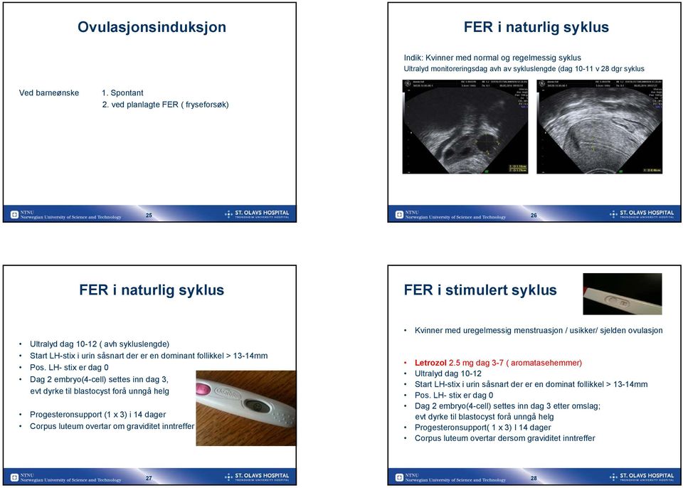 LH- stix er dag 0 Dag 2 embryo(4-cell) settes inn dag 3, evt dyrke til blastocyst forå unngå helg Progesteronsupport (1 x 3) i 14 dager Corpus luteum overtar om graviditet inntreffer Kvinner med