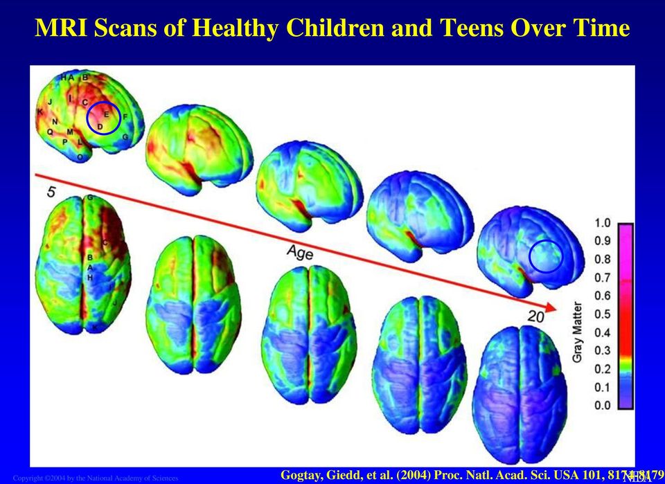 Academy of Sciences Gogtay, Giedd, et al.