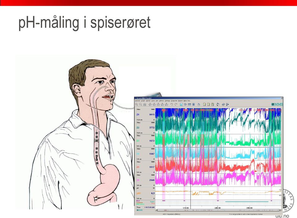 spserøret