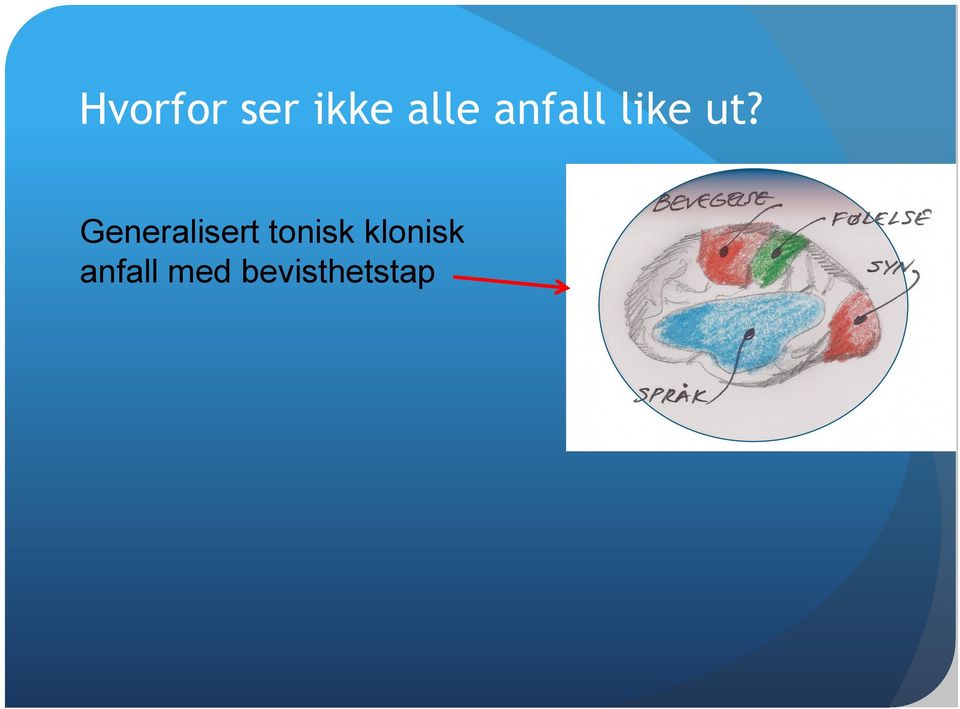 Generalisert tonisk