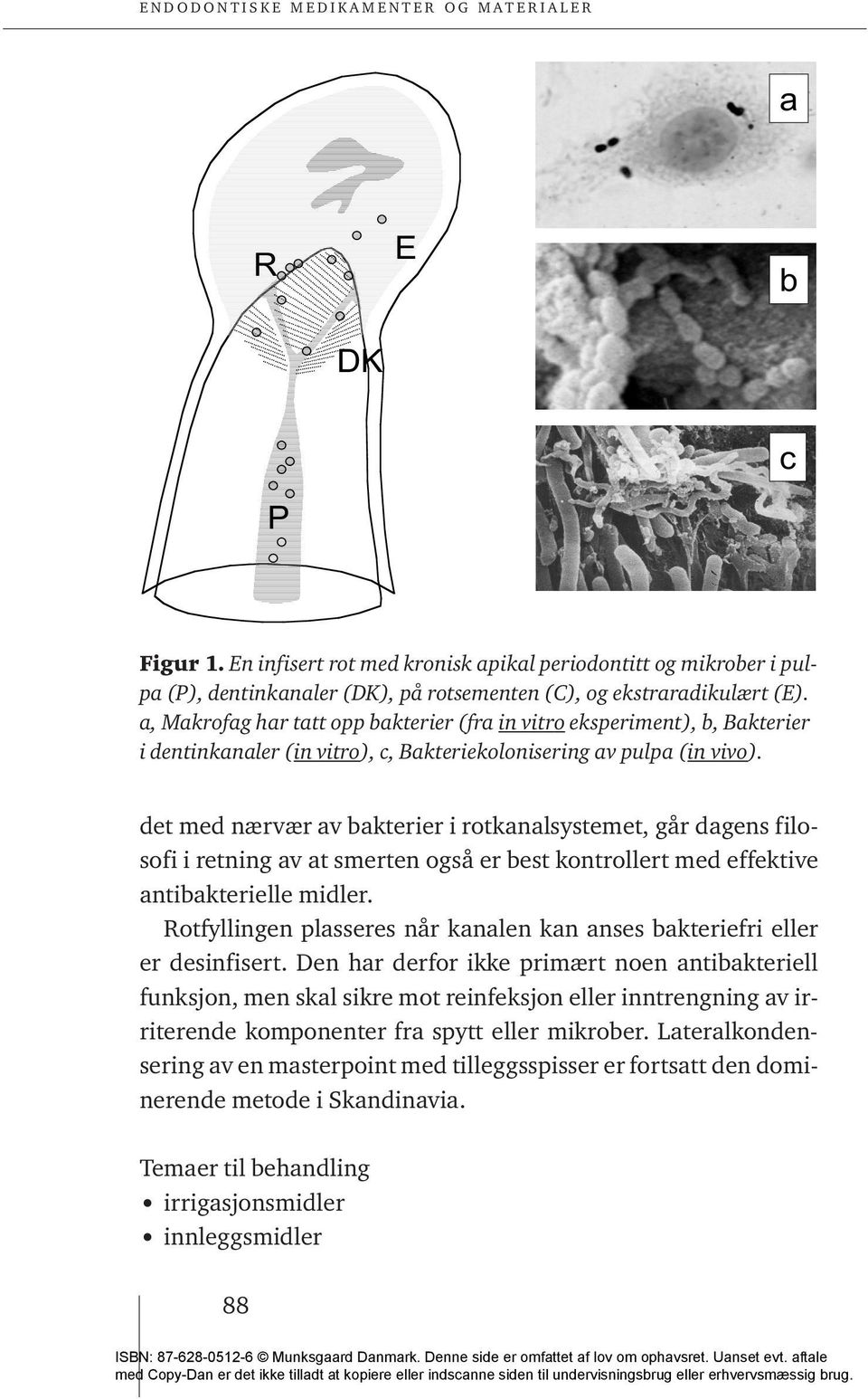 a, Makrofag har tatt opp bakterier (fra in vitro eksperiment), b, Bakterier i dentinkanaler (in vitro), c, Bakteriekolonisering av pulpa (in vivo).