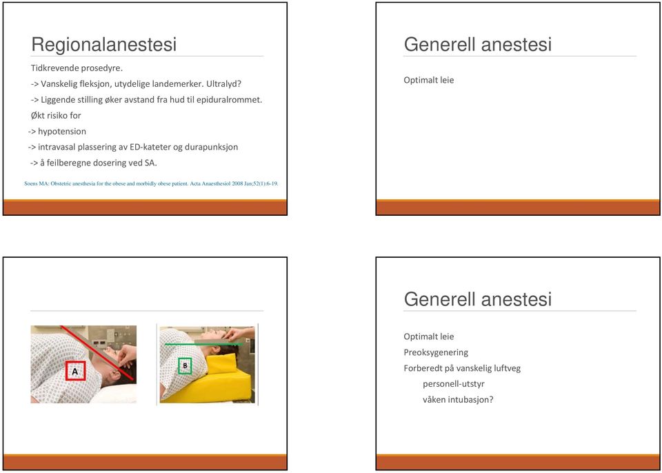 Økt risiko for > hypotension > intravasal plassering av ED kateter og durapunksjon > å feilberegne dosering ved SA.