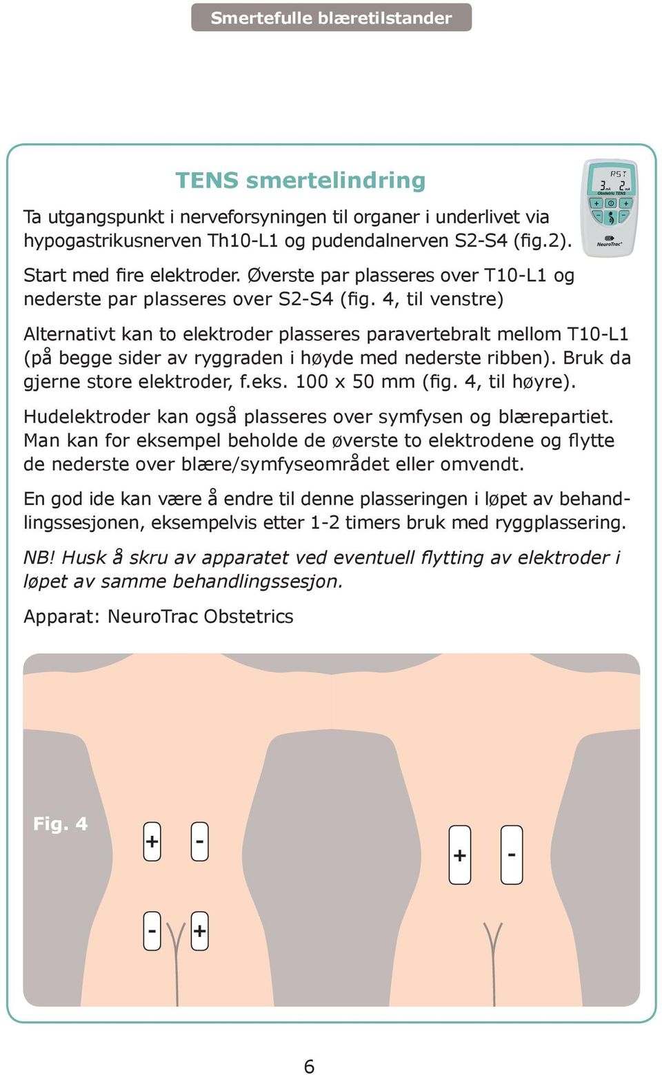 4, til venstre) Alternativt kan to elektroder plasseres paravertebralt mellom T10-L1 (på begge sider av ryggraden i høyde med nederste ribben). Bruk da gjerne store elektroder, f.eks.