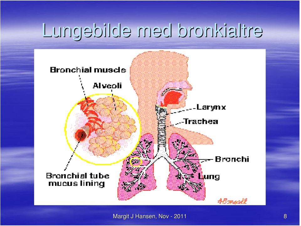 bronkialtre