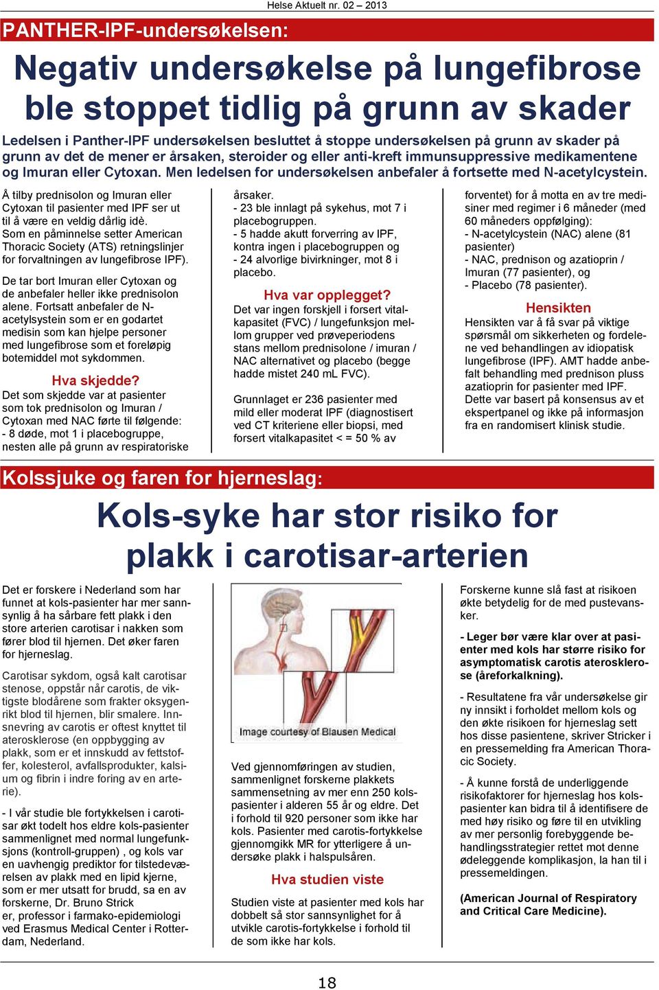 på grunn av det de mener er årsaken, steroider og eller anti-kreft immunsuppressive medikamentene og Imuran eller Cytoxan. Men ledelsen for undersøkelsen anbefaler å fortsette med N-acetylcystein.