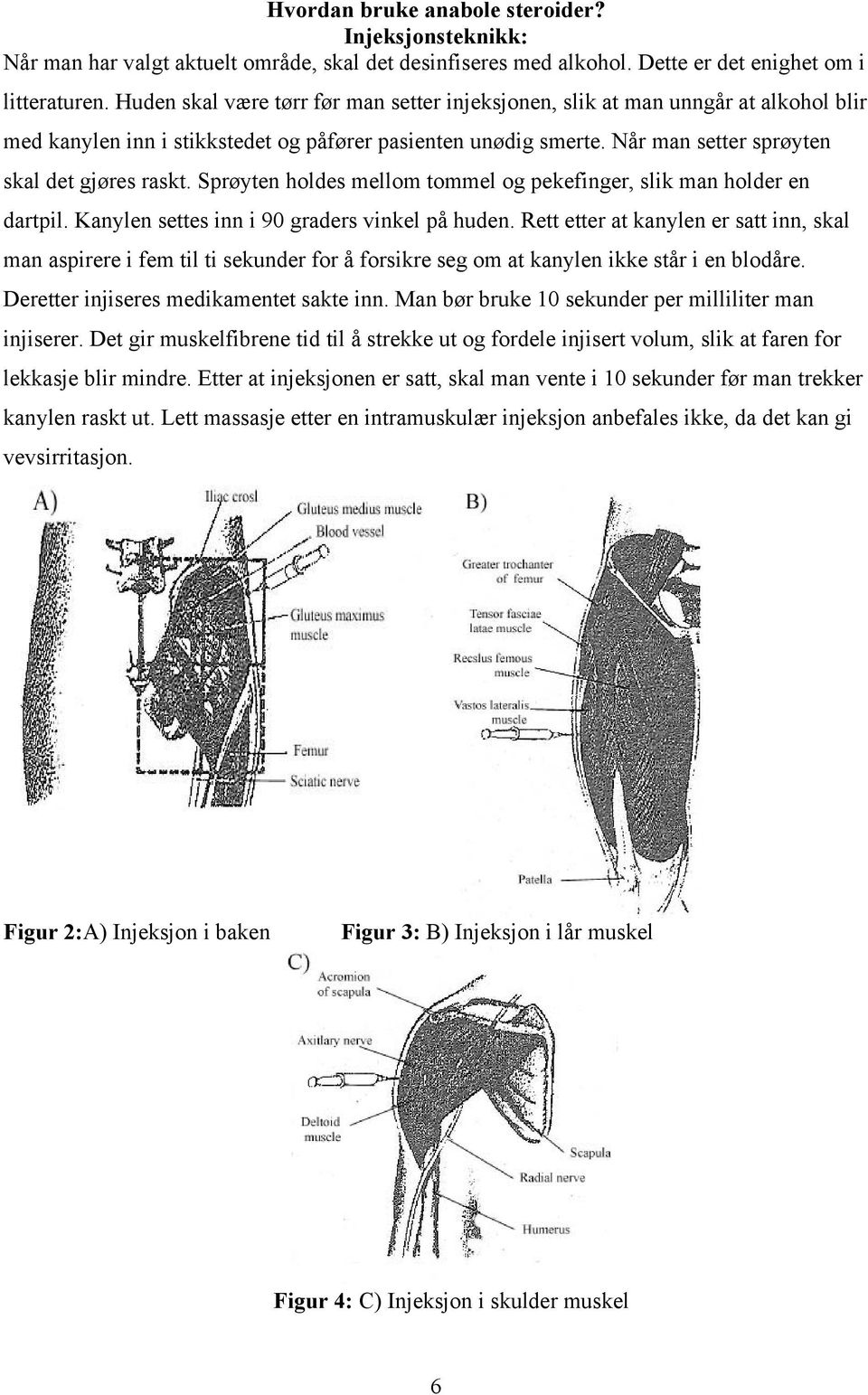 Sprøyten holdes mellom tommel og pekefinger, slik man holder en dartpil. Kanylen settes inn i 90 graders vinkel på huden.