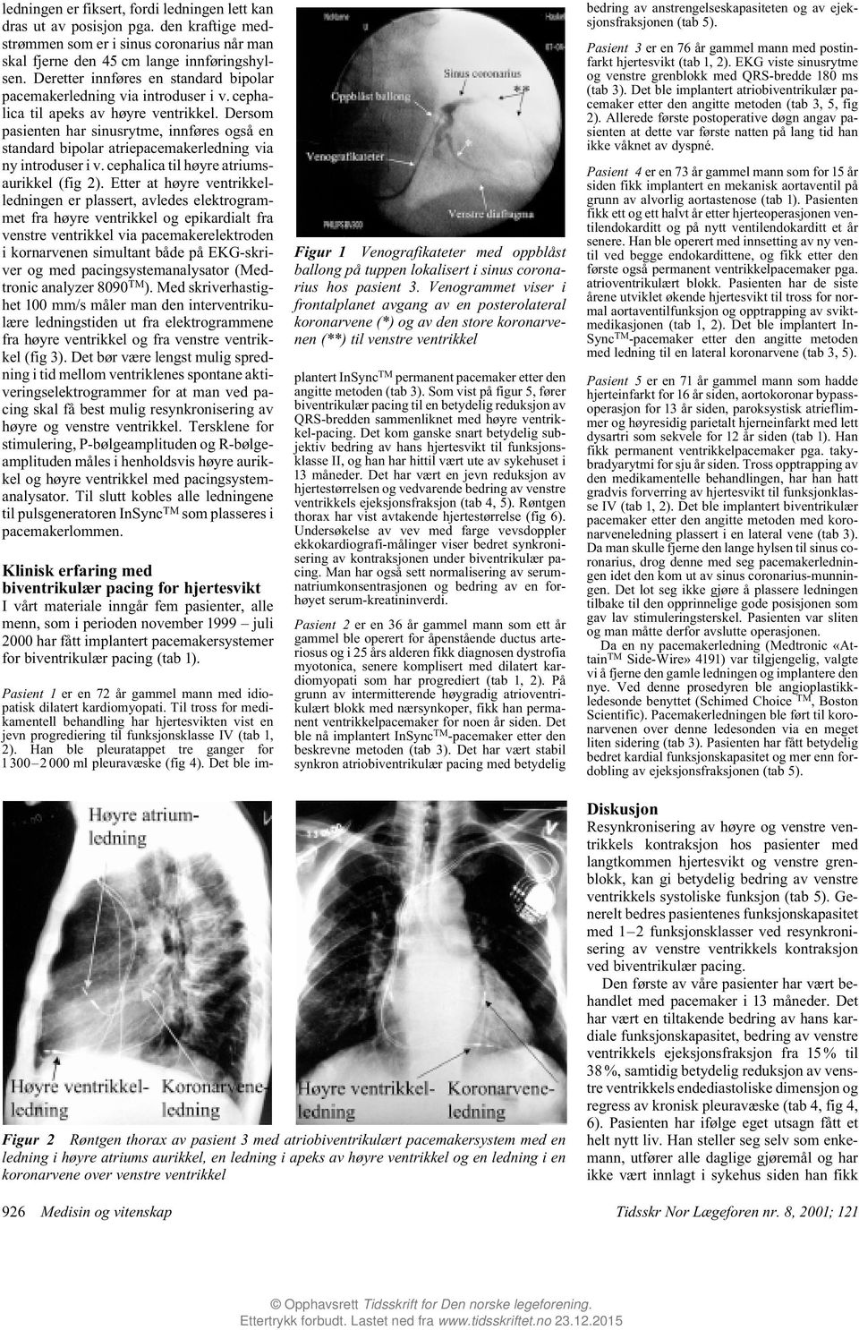 Dersom pasienten har sinusrytme, innføres også en standard bipolar atriepacemakerledning via ny introduser i v. cephalica til høyre atriumsaurikkel (fig 2).