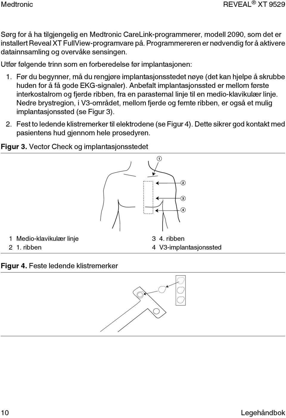 Før du begynner, må du rengjøre implantasjonsstedet nøye (det kan hjelpe å skrubbe huden for å få gode EKG-signaler).