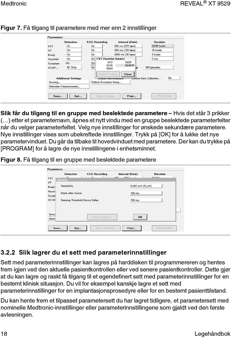 beslektede parameterfelter når du velger parameterfeltet. Velg nye innstillinger for ønskede sekundære parametere. Nye innstillinger vises som ubekreftede innstillinger.