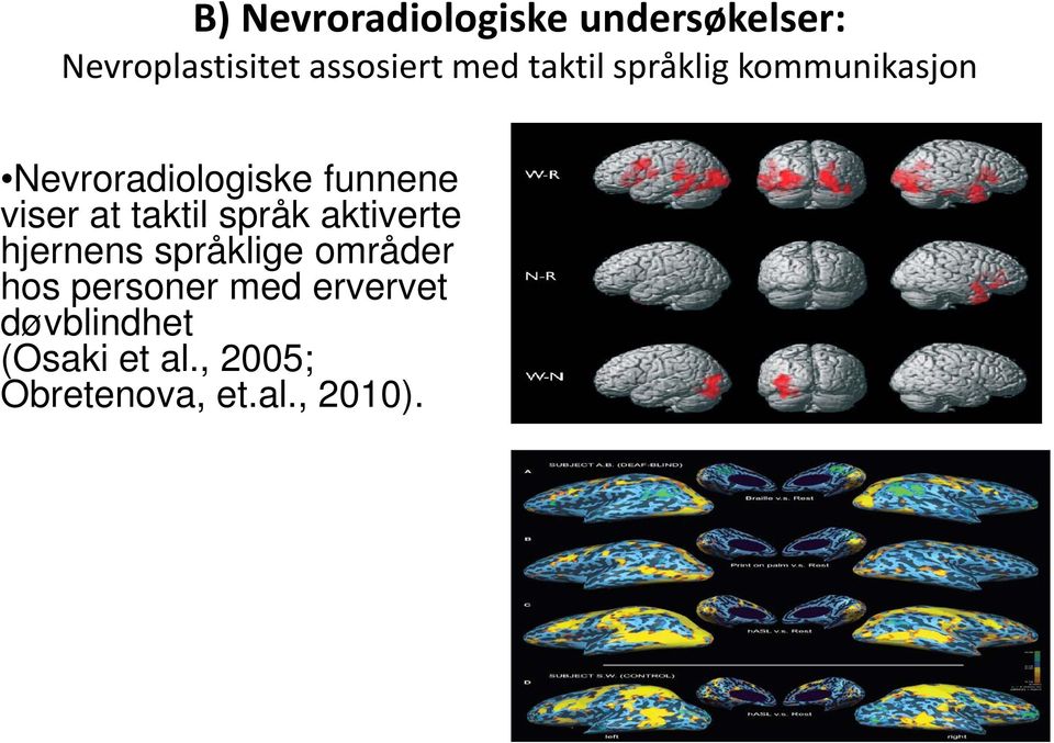 taktil språk aktiverte hjernens språklige områder hos personer med