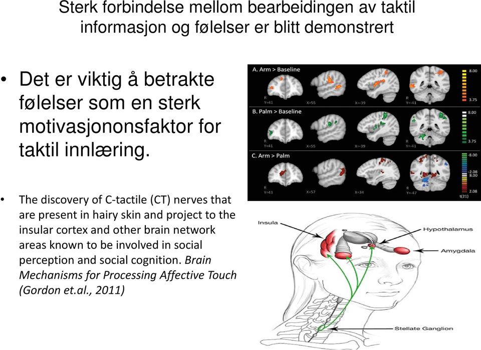 The discovery of C-tactile (CT) nerves that are present in hairy skin and project to the insular cortex and