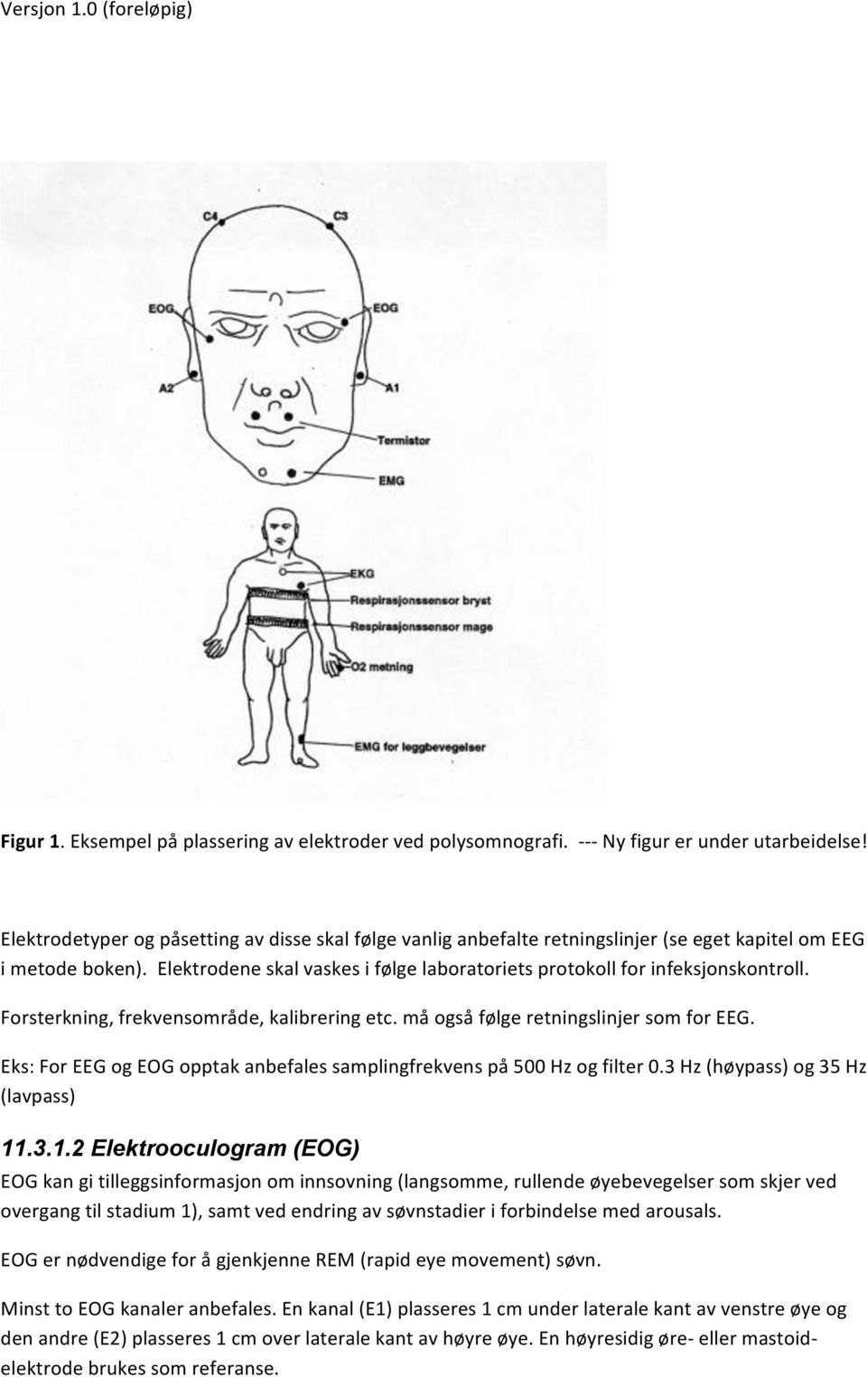 Forsterkning, frekvensområde, kalibrering etc. må også følge retningslinjer som for EEG. Eks: For EEG og EOG opptak anbefales samplingfrekvens på 500 Hz og filter 0.