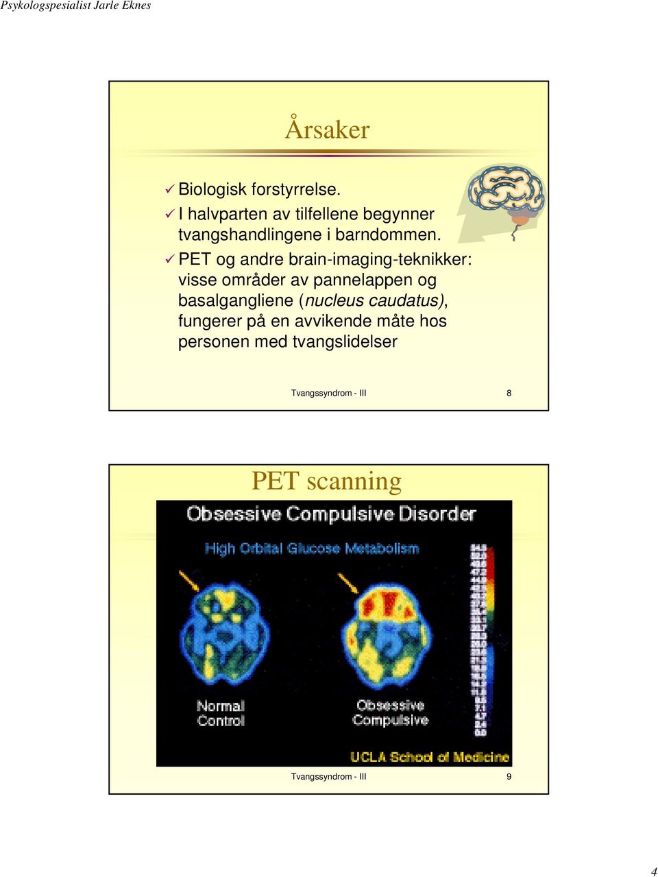 PET og andre brain-imaging-teknikker: visse områder av pannelappen og