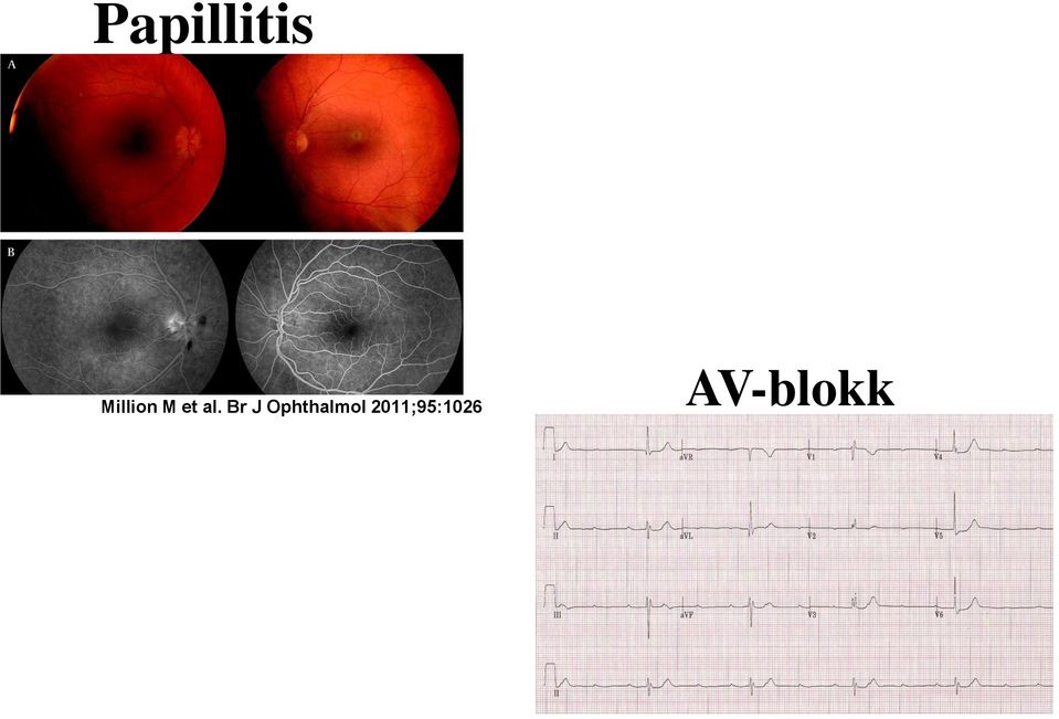 Br J Ophthalmol