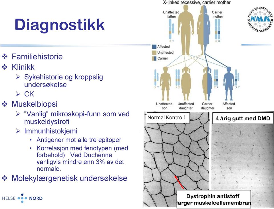 med fenotypen (med forbehold) Ved Duchenne vanligvis mindre enn 3% av det normale.