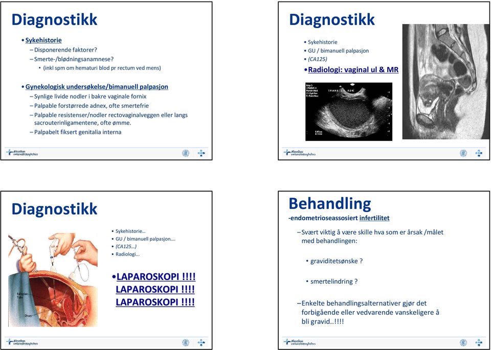 i bakre vaginale fornix Palpable forstørrede adnex, ofte smertefrie Palpable resistenser/nodler rectovaginalveggen eller langs sacrouterinligamentene, ofte ømme.