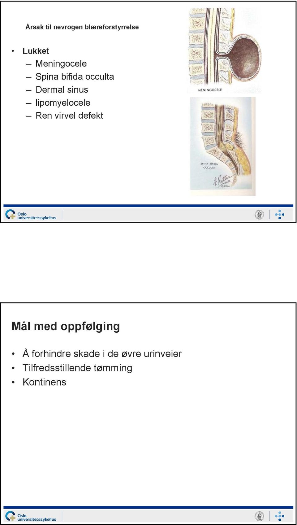 lipomyelocele Ren virvel defekt Mål med oppfølging Å