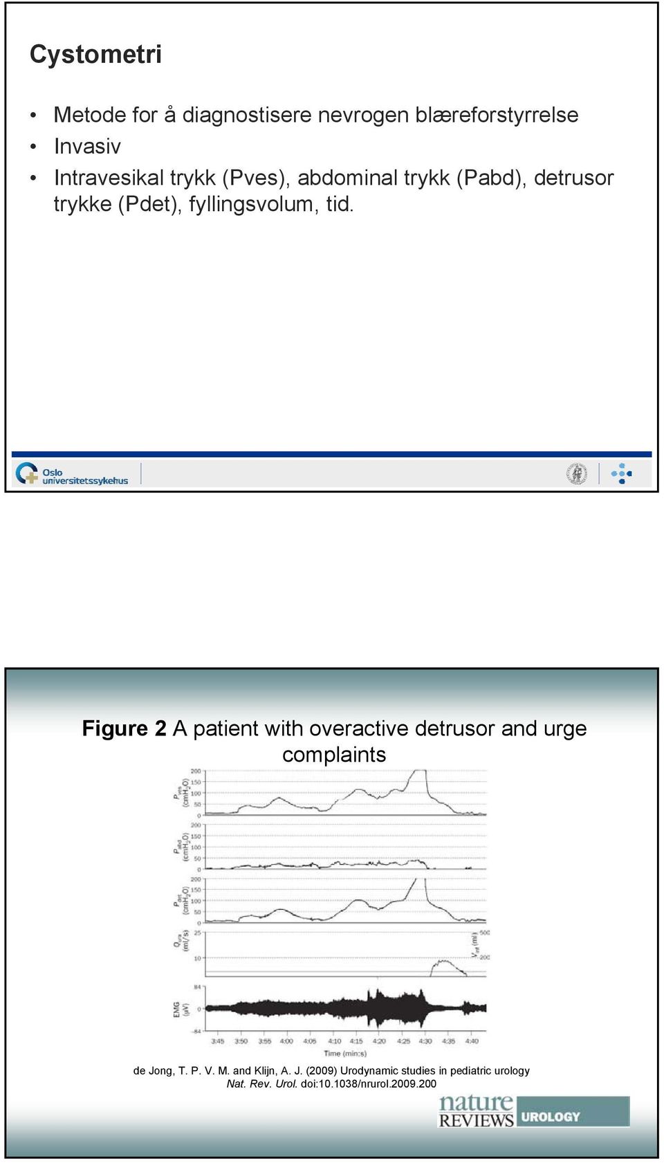 Figure 2 A patient with overactive detrusor and urge complaints de Jong, T. P. V. M.