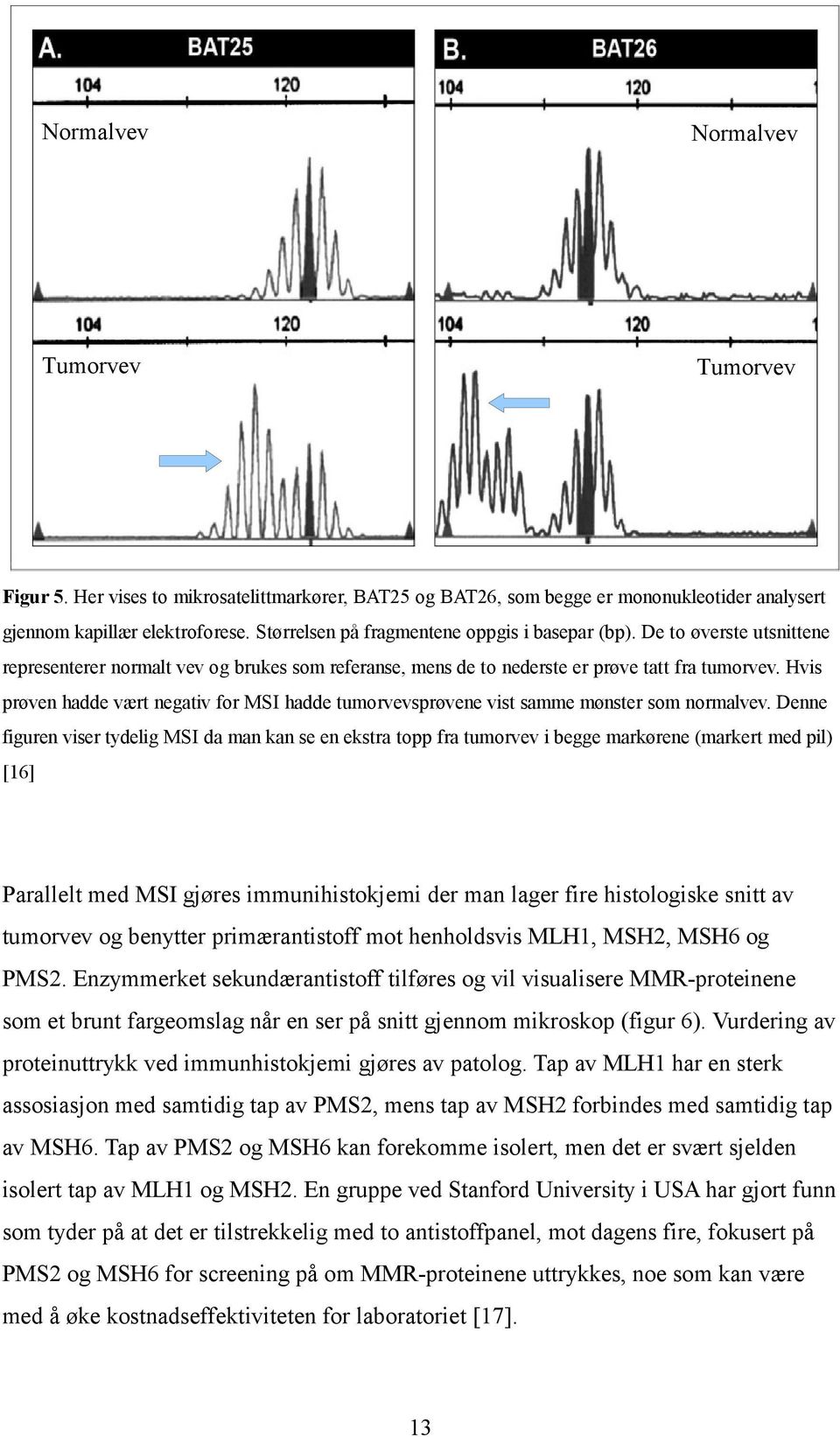 Hvis prøven hadde vært negativ for MSI hadde tumorvevsprøvene vist samme mønster som normalvev.