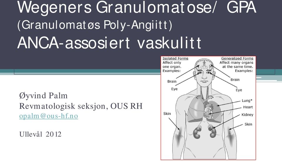 ANCA-assosiert vaskulitt Øyvind Palm