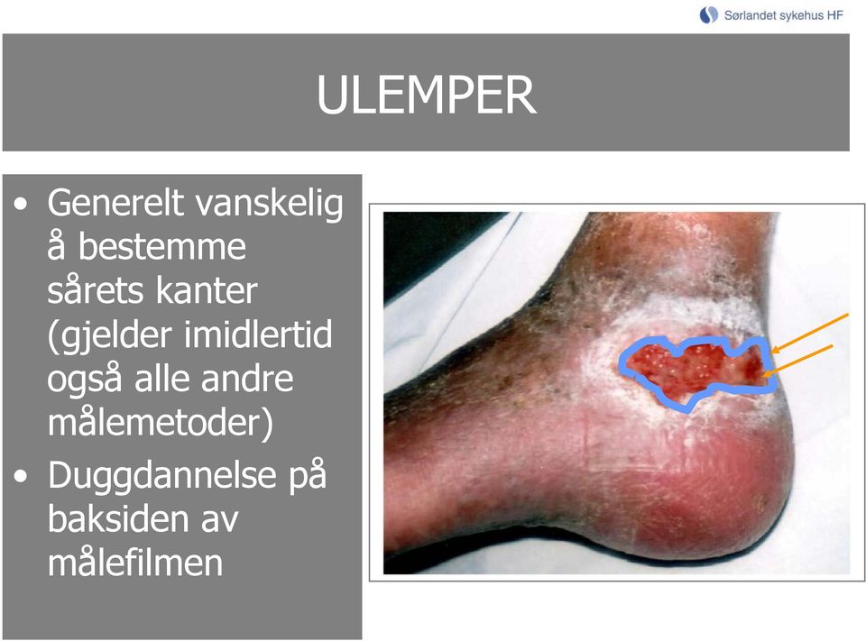 imidlertid også alle andre