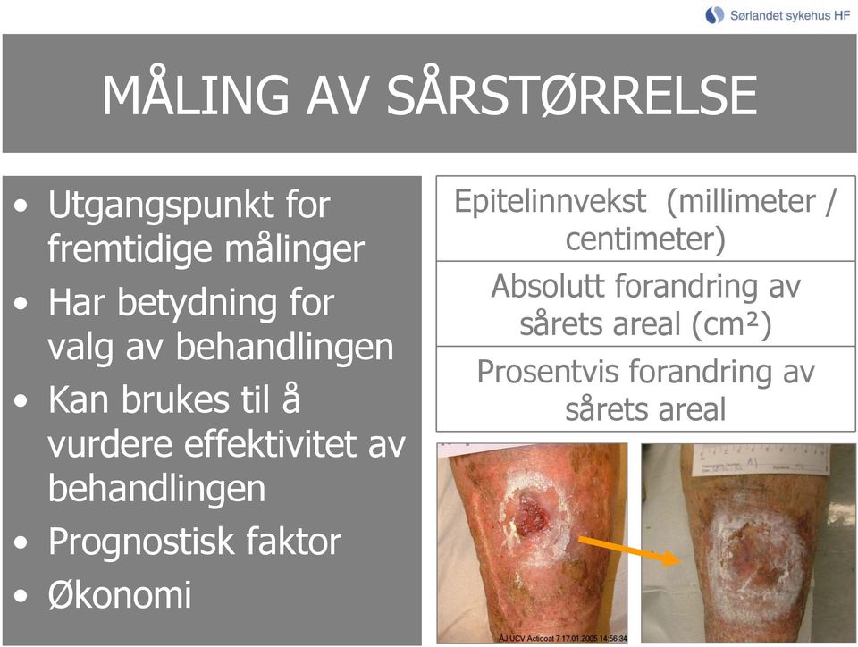 behandlingen Prognostisk faktor Økonomi Epitelinnvekst (millimeter /