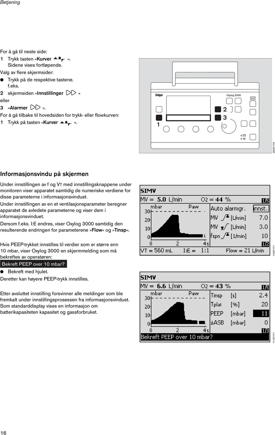 06237170 Informasjonsvindu på skjermen Under innstillingen av f og VT med innstillingsknappene under monitoren viser apparatet samtidig de numeriske verdiene for disse parameterne i