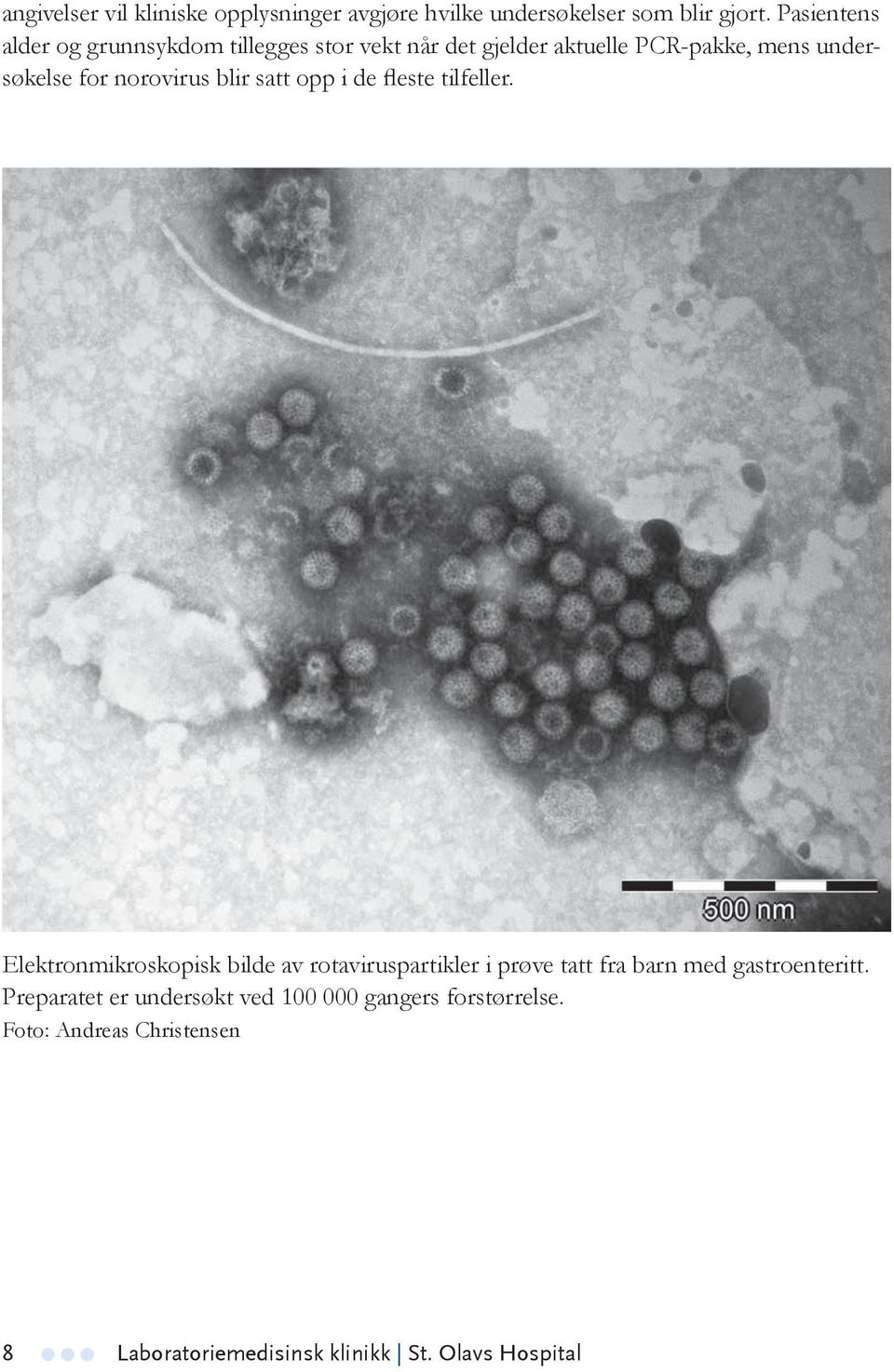 norovirus blir satt opp i de fleste tilfeller.