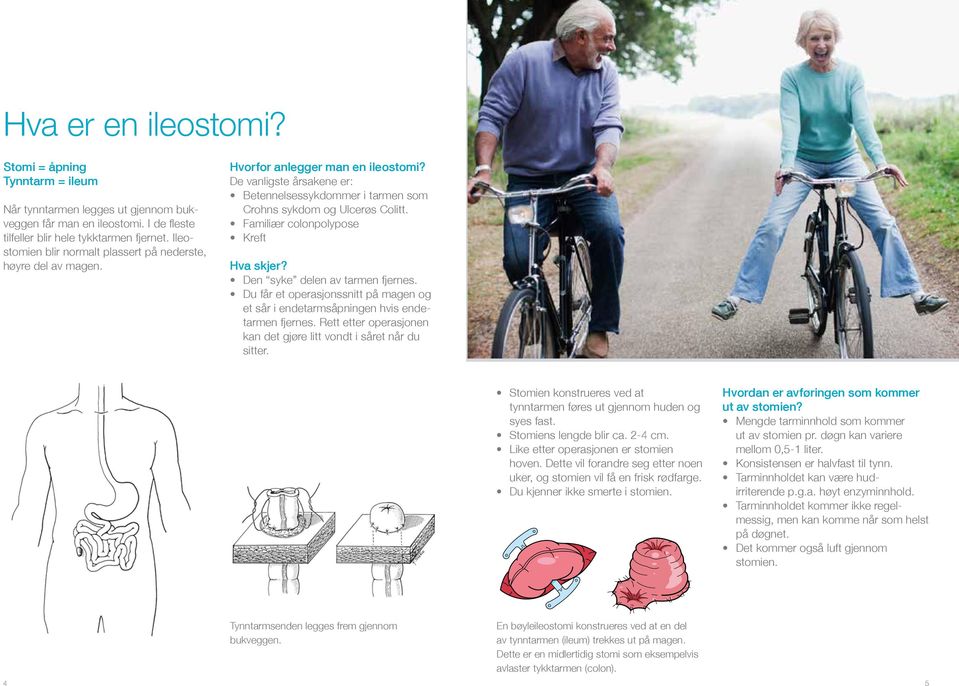 Familiær colonpolypose Kreft Hva skjer? Den syke delen av tarmen fjernes. Du får et operasjonssnitt på magen og et sår i endetarmsåpningen hvis endetarmen fjernes.