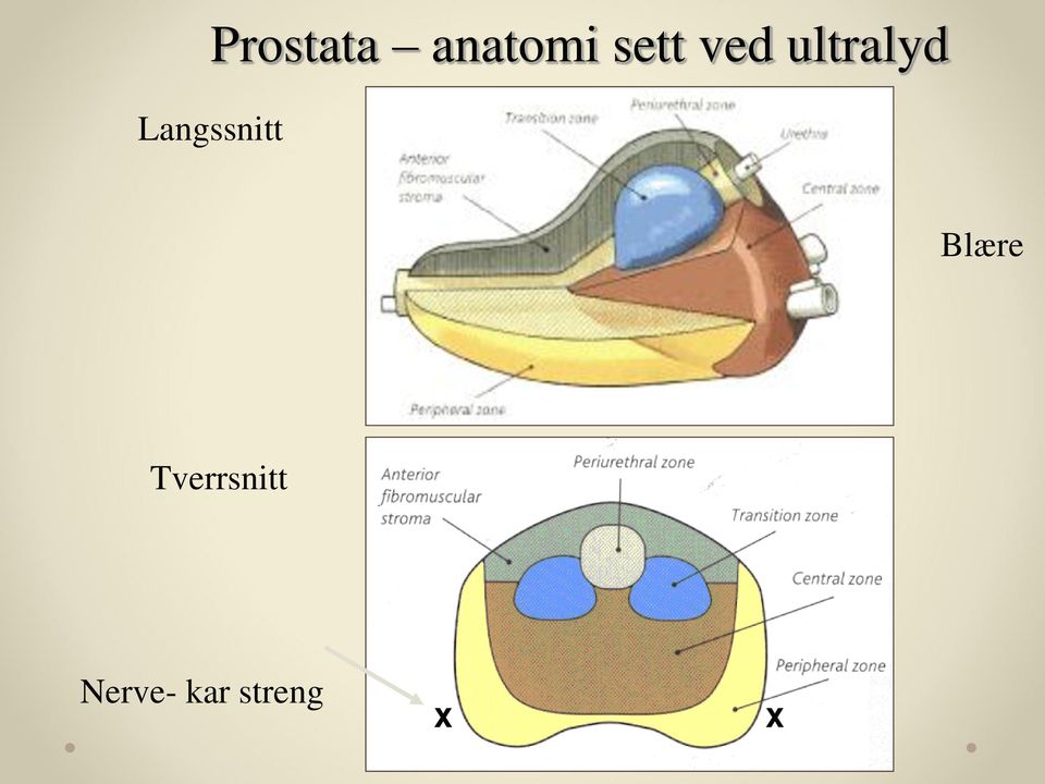 Langssnitt Blære