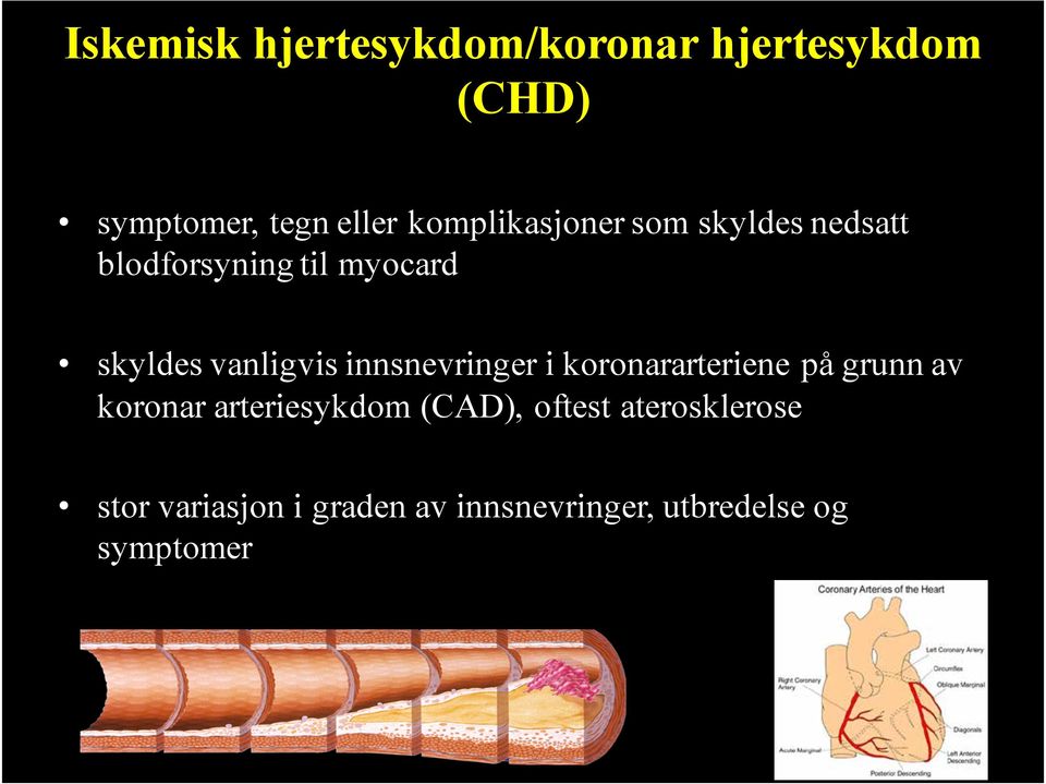 vanligvis innsnevringer i koronararteriene på grunn av koronar arteriesykdom