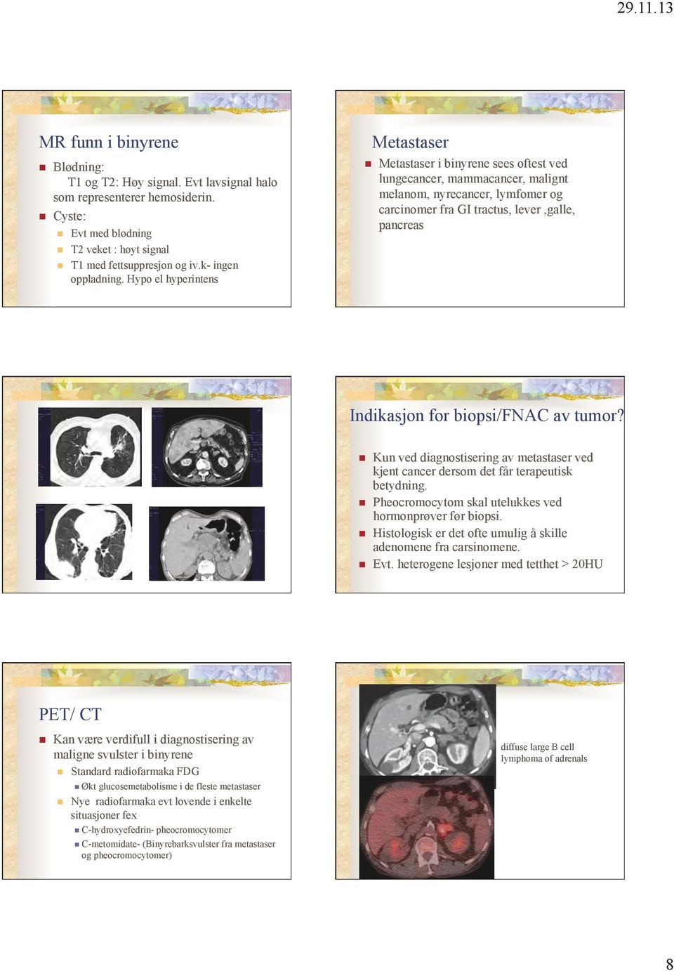 biopsi/fnac av tumor? Kun ved diagnostisering av metastaser ved kjent cancer dersom det får terapeutisk betydning. Pheocromocytom skal utelukkes ved hormonprøver før biopsi.