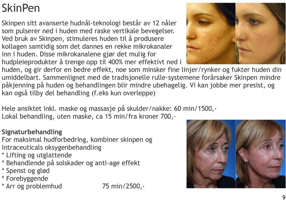 Disse mikrokanalene gjør det mulig for hudpleieprodukter å trenge opp til 400% mer effektivt ned i huden, og gir derfor en bedre effekt, noe som minsker fine linjer/rynker og fukter huden din