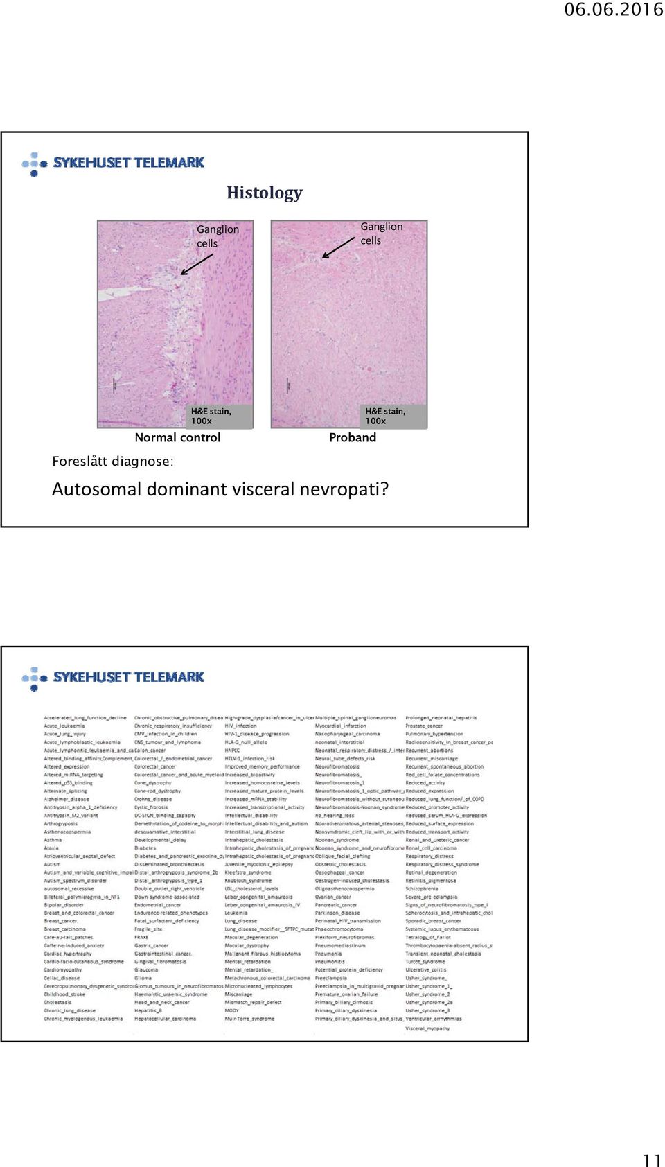 control Proband H&E stain, 00x Autosomal