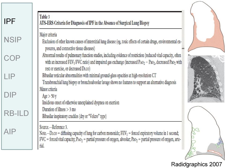 RB-ILD AIP