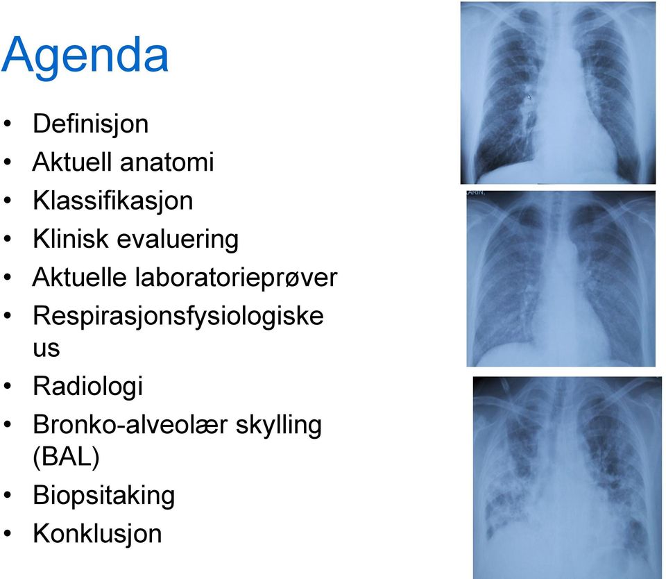 laboratorieprøver Respirasjonsfysiologiske us