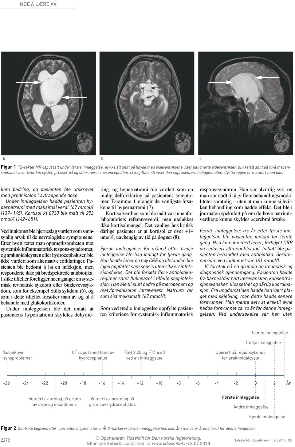 Cysteveggen er markert med piler kom bedring, og pasienten ble utskrevet med prednisolon i avtrappende dose. Under innleggelsen hadde pasienten hypernatremi med maksimal verdi 167 mmol/l (137 145).