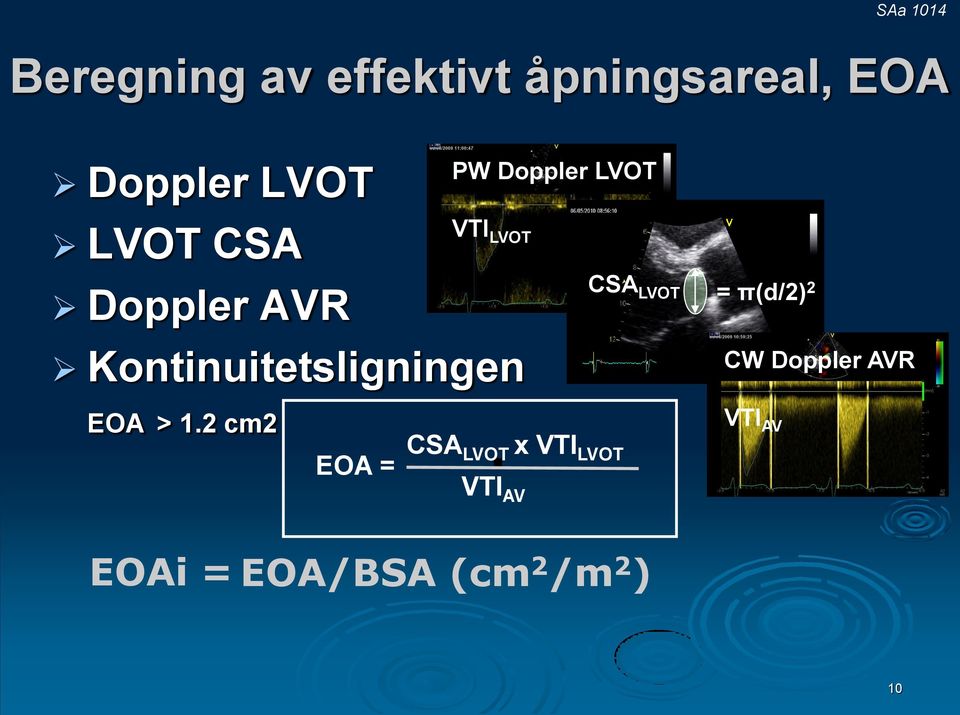 Kontinuitetsligningen CSA LVOT = π(d/2) 2 CW Doppler AVR EOA