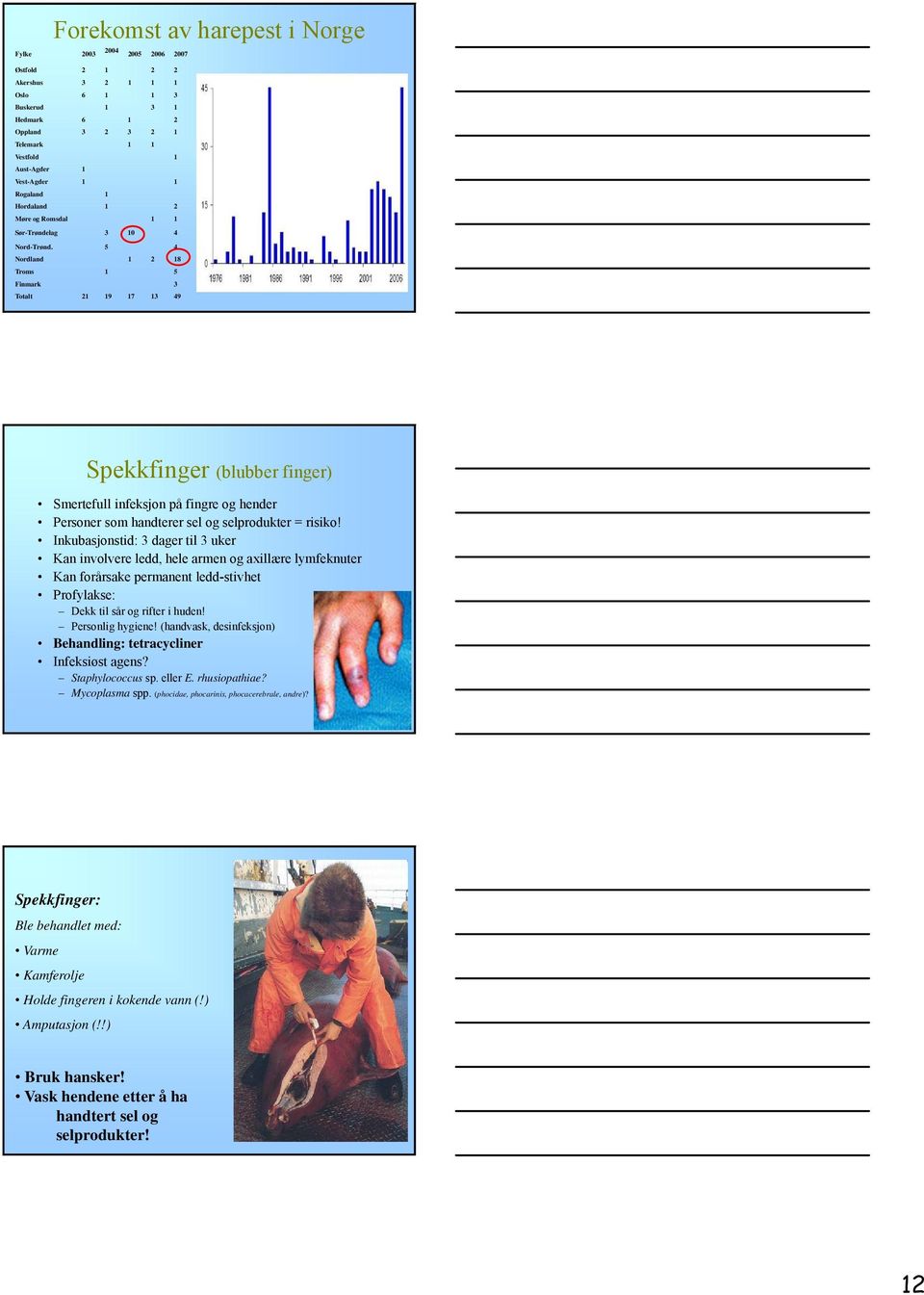 5 4 Nordland 1 2 18 Troms 1 5 Finmark 3 Totalt 21 19 17 13 49 Spekkfinger (blubber finger) Smertefull infeksjon på fingre og hender Personer som handterer sel og selprodukter = risiko!