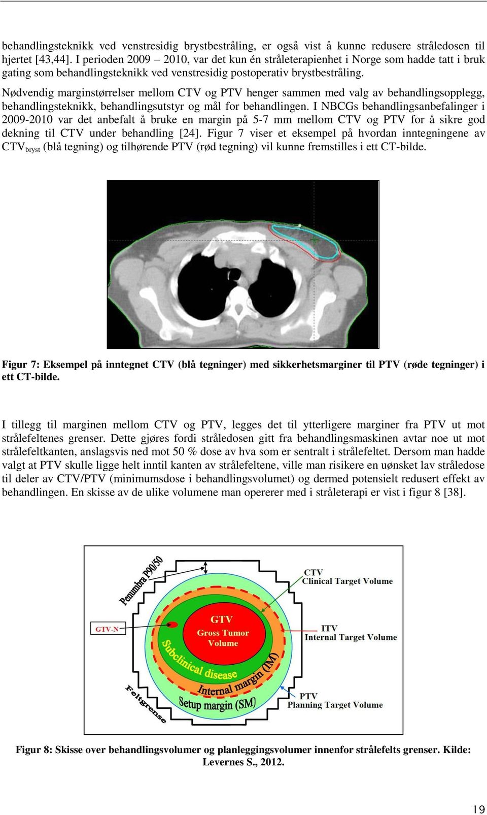 Nødvendig marginstørrelser mellom CTV og PTV henger sammen med valg av behandlingsopplegg, behandlingsteknikk, behandlingsutstyr og mål for behandlingen.
