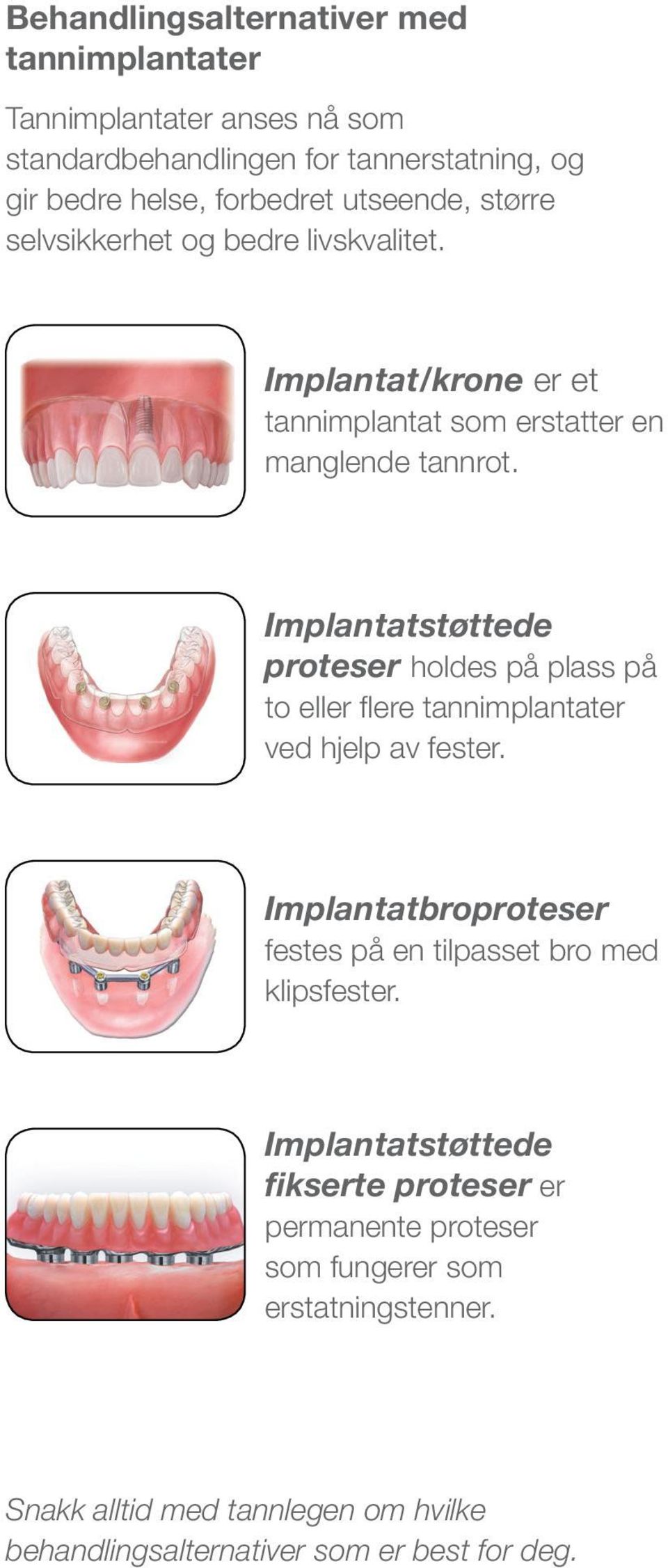 Implantatstøttede proteser holdes på plass på to eller flere tannimplantater ved hjelp av fester.