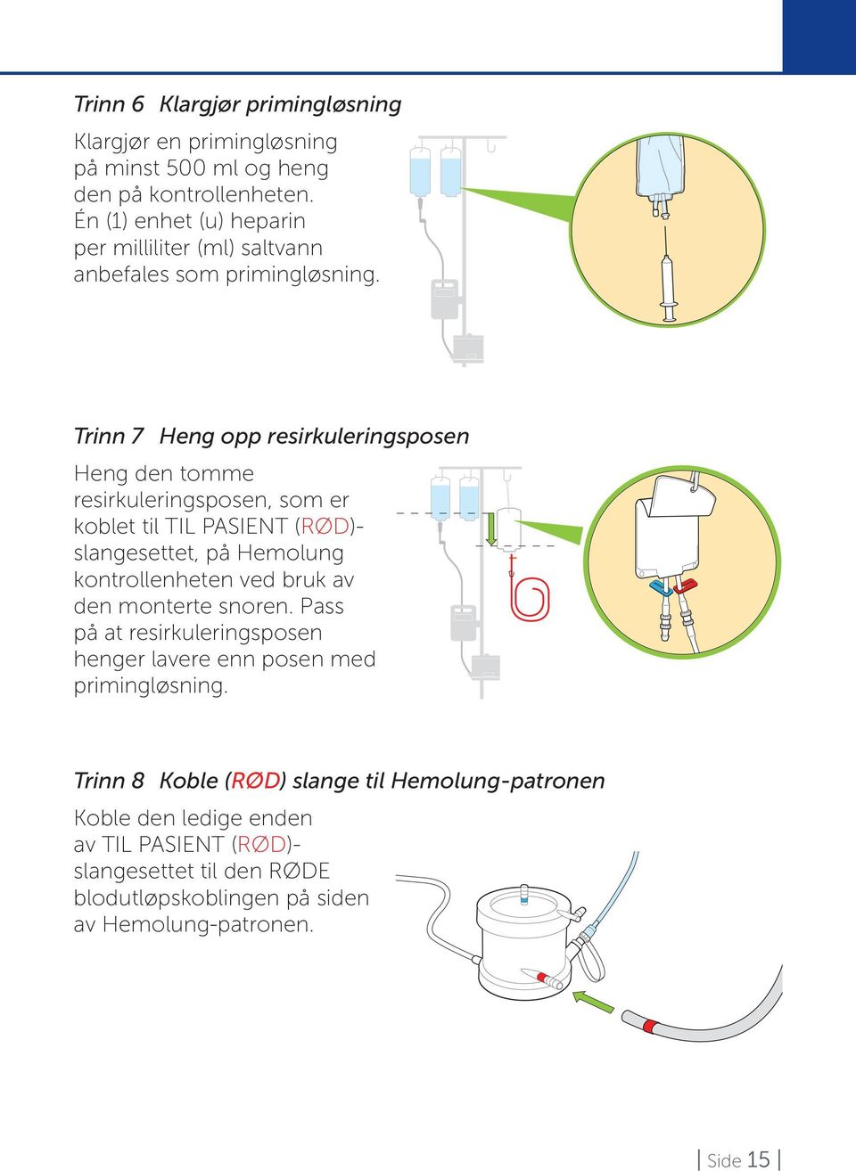 Trinn 7 Heng opp resirkuleringsposen Heng den tomme resirkuleringsposen, som er koblet til TIL PASIENT (RØD)- slangesettet, på Hemolung kontrollenheten ved