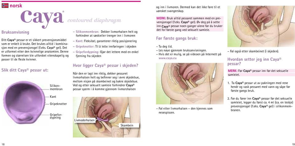 Slik ditt Caya pessar ut: Silikonmembran Kant Gripeknotter Gripefordypning contoured diaphragm Silikonmembran: Dekker livmorhalsen helt og forhindrer at sædceller trenger inn i livmoren Kant: